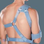 acromion 2