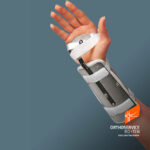 Ferula dr. Bunnel per estensione polso - Ro+Ten Splint PR21