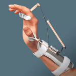 Ferula “Thomas” del dr. Bunnel per estensione polso, metacarpi e abduzione pollice - Ro+Ten Splint PR24