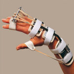 Ferula dr. Bunnel per mano e polso (flessione polso - estensione dita - abduzione pollice) - Ro+Ten Splint PR28A
