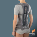 Tutore per Osteoporosi e Ipercifosi - Ro+Ten Spinalplus 3